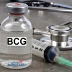 Tuberculosis